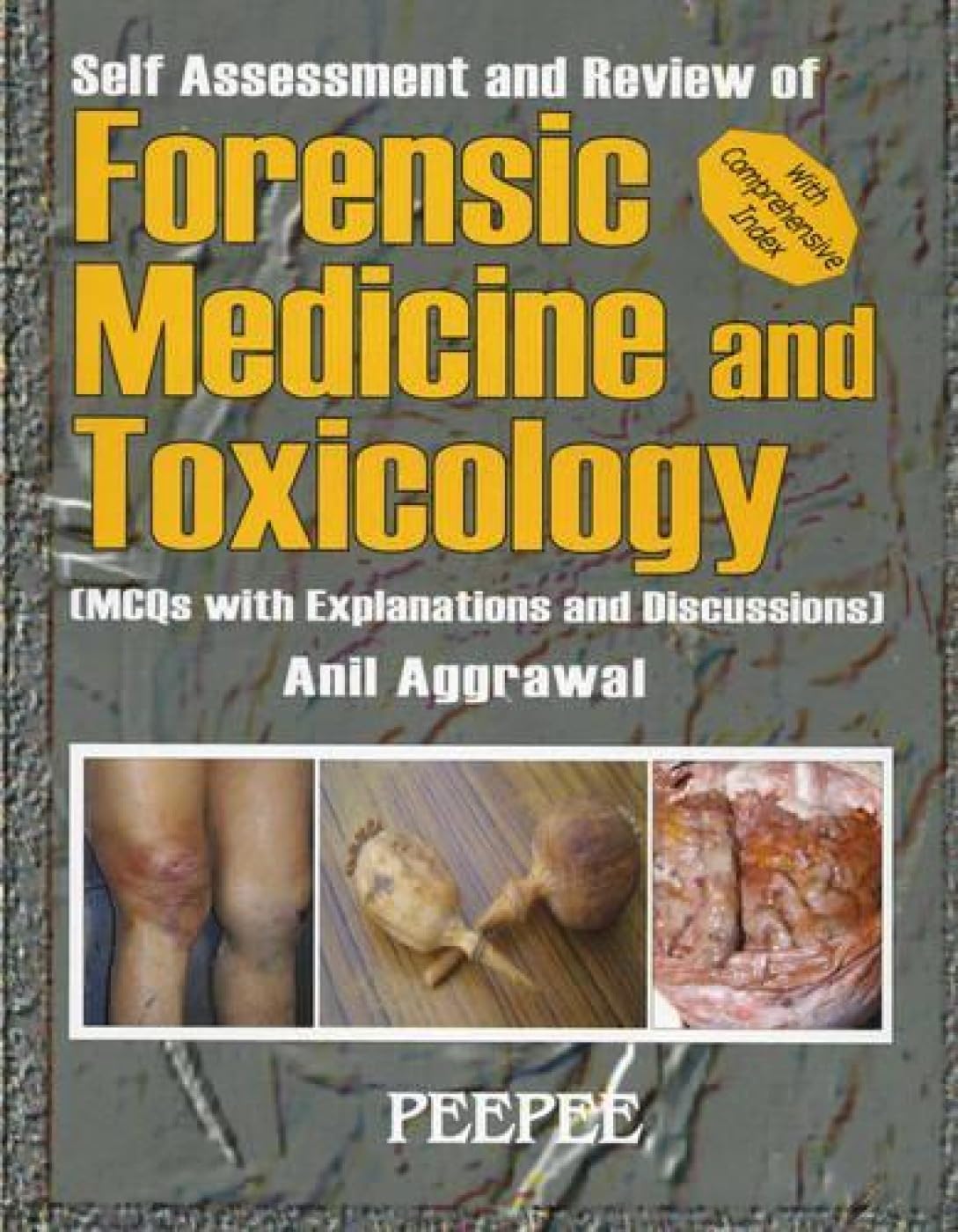 Self Assessment And Review Of Forensic Medicine: Volume 1-Anil Aggrawal