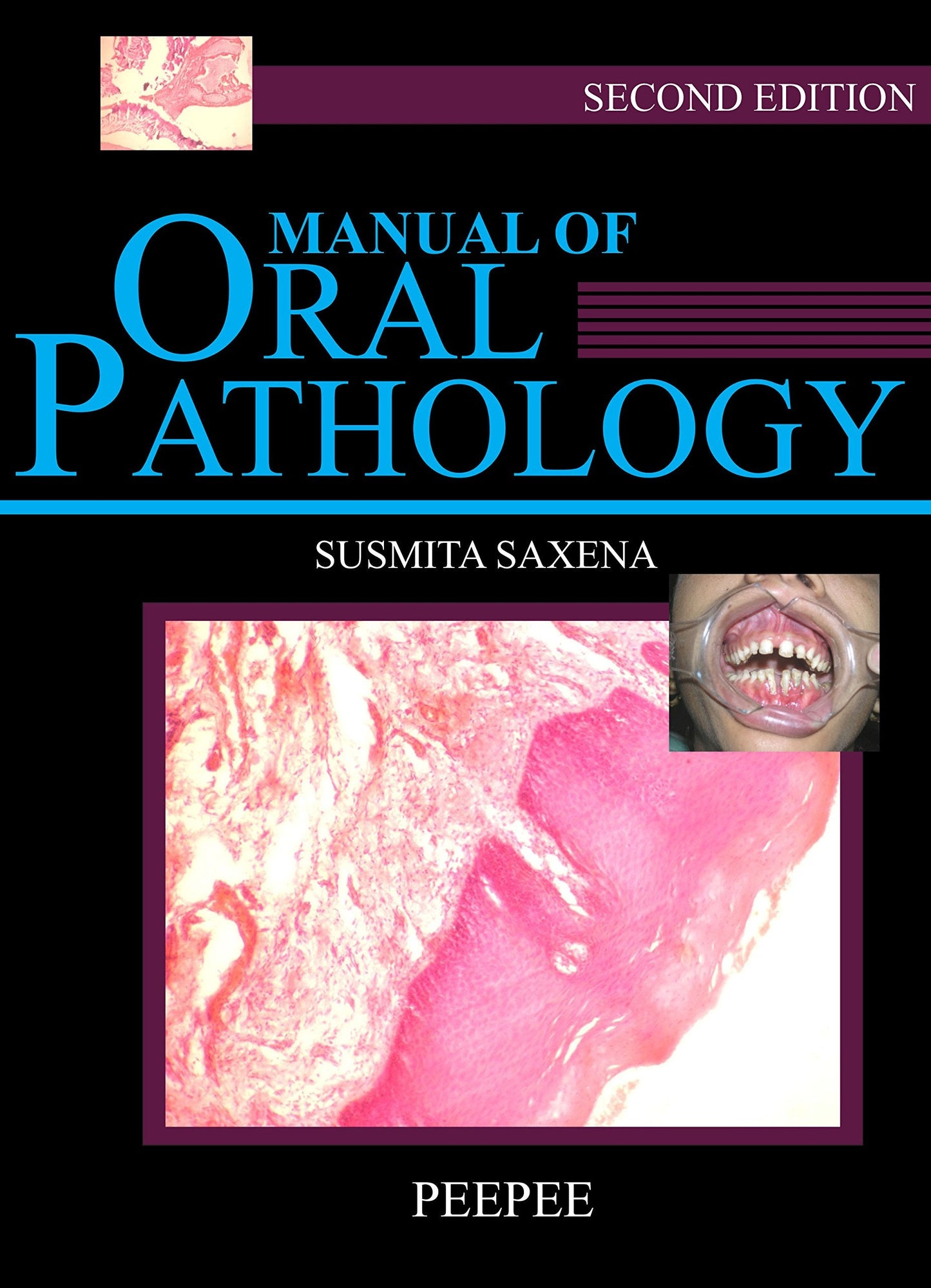 Manual Of Oral Pathology-Sushmita Saxena