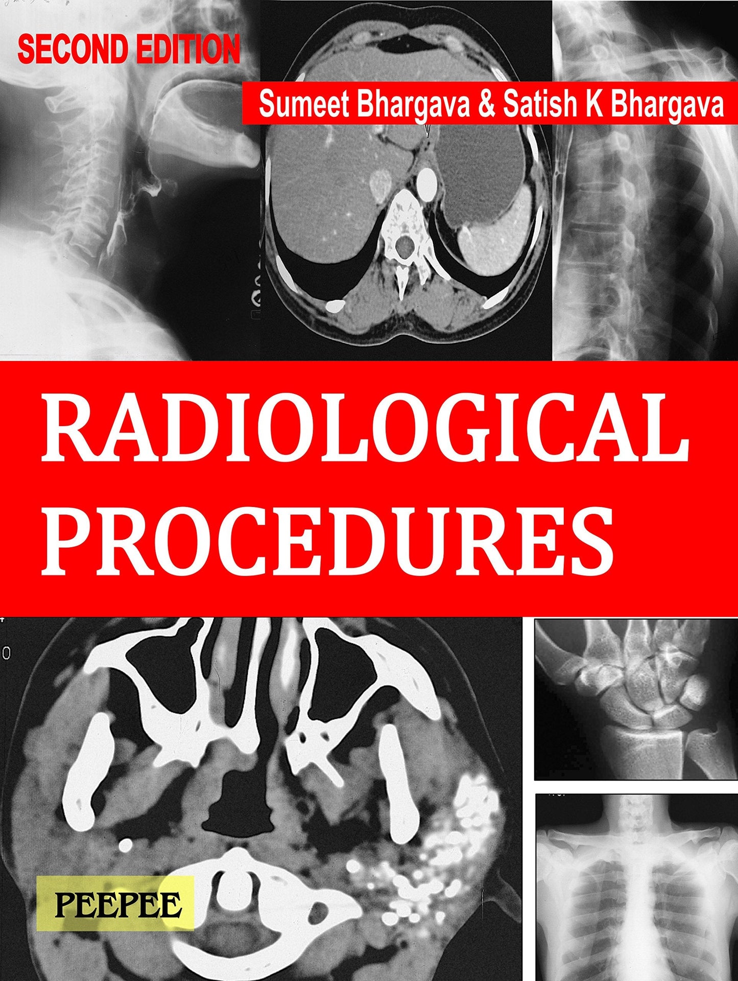 Radiological Procedures, 2E-Bhargava