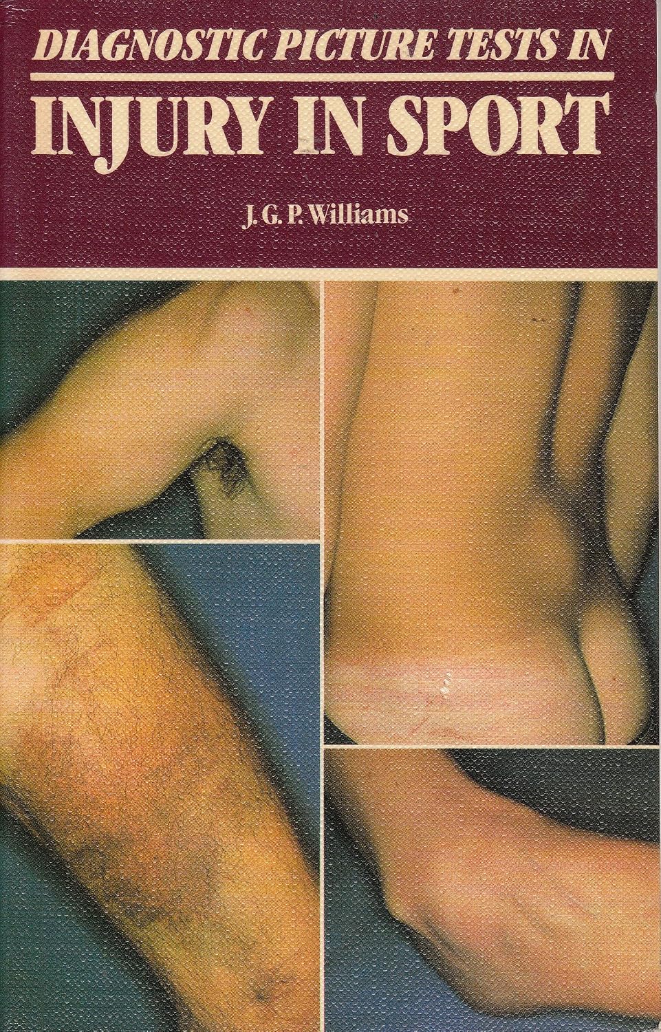 Diagnostic Picture Tests In Sports Injuries (diagnostic Picture Tests) by Williams,