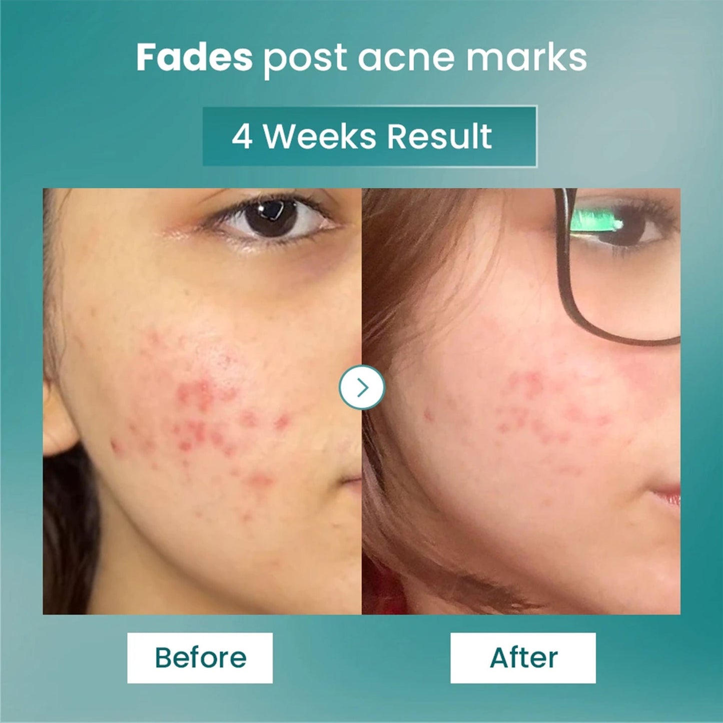 The Solved Skin Spot Fade Advance Repair Serum