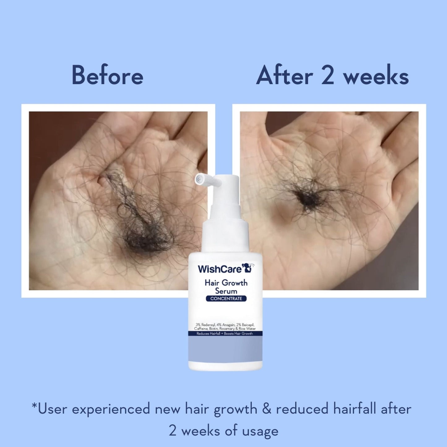 Wishcare Hair Growth Serum Concentrate In-Vivo Tested Redensyl, Anagain, Biotin,Keratin & Rice Water