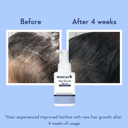Wishcare Hair Growth Serum Concentrate In-Vivo Tested Redensyl, Anagain, Biotin,Keratin & Rice Water