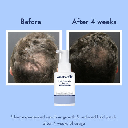 Wishcare Hair Growth Serum Concentrate In-Vivo Tested Redensyl, Anagain, Biotin,Keratin & Rice Water