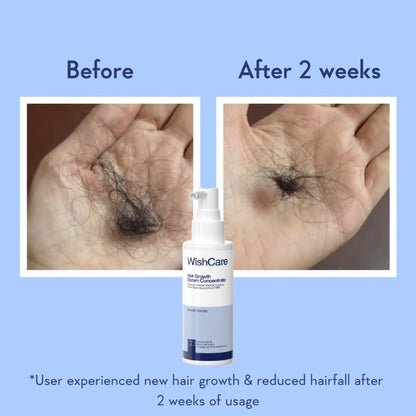 WishCare Hair Growth Serum Concentrate with Redensyl & Rosemary-In-Vivo Tested-Controls Hairfall