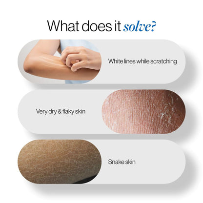 BeBodywise 20% Urea Body Lotion - Advanced Formulation