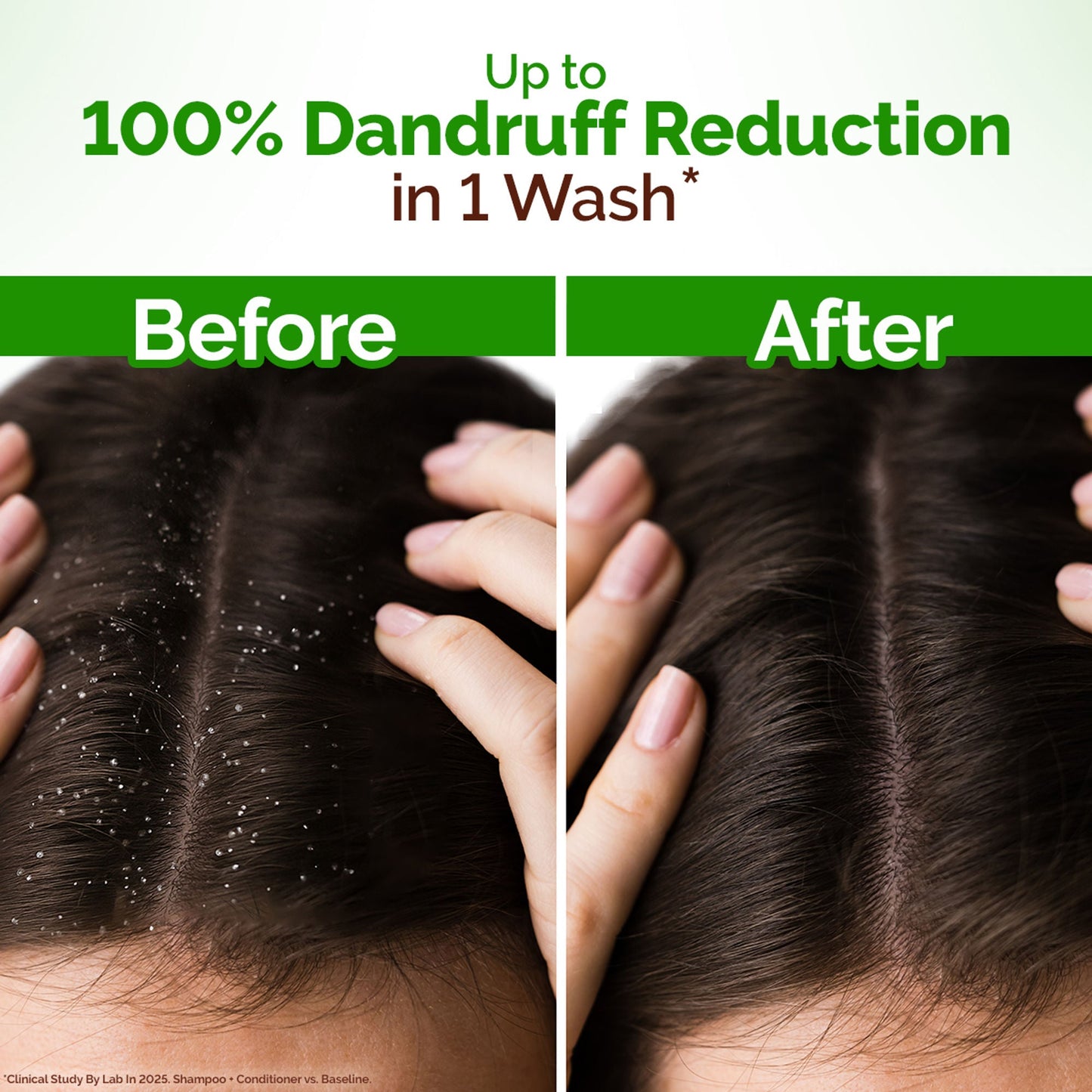 Mamaearth Lemon Anti-Dandruff Shampoo