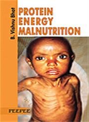 Protein Energy Malnutrition: Volume 1-Bhat