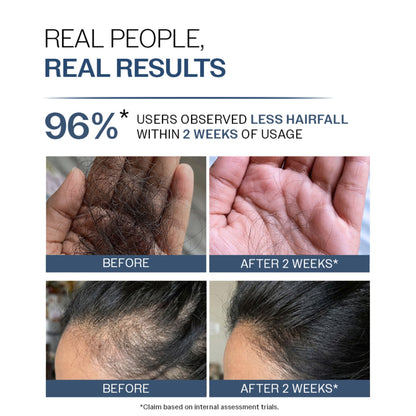 Bare Anatomy Anti-Hair Fall Shampoo 5X Hair Fall Control With Peptides