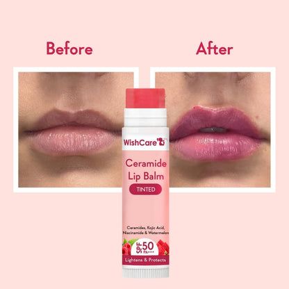 Tinted Lip Balm SPF 50 PA+++ with Kojic Acid & Niacinamide 5g
