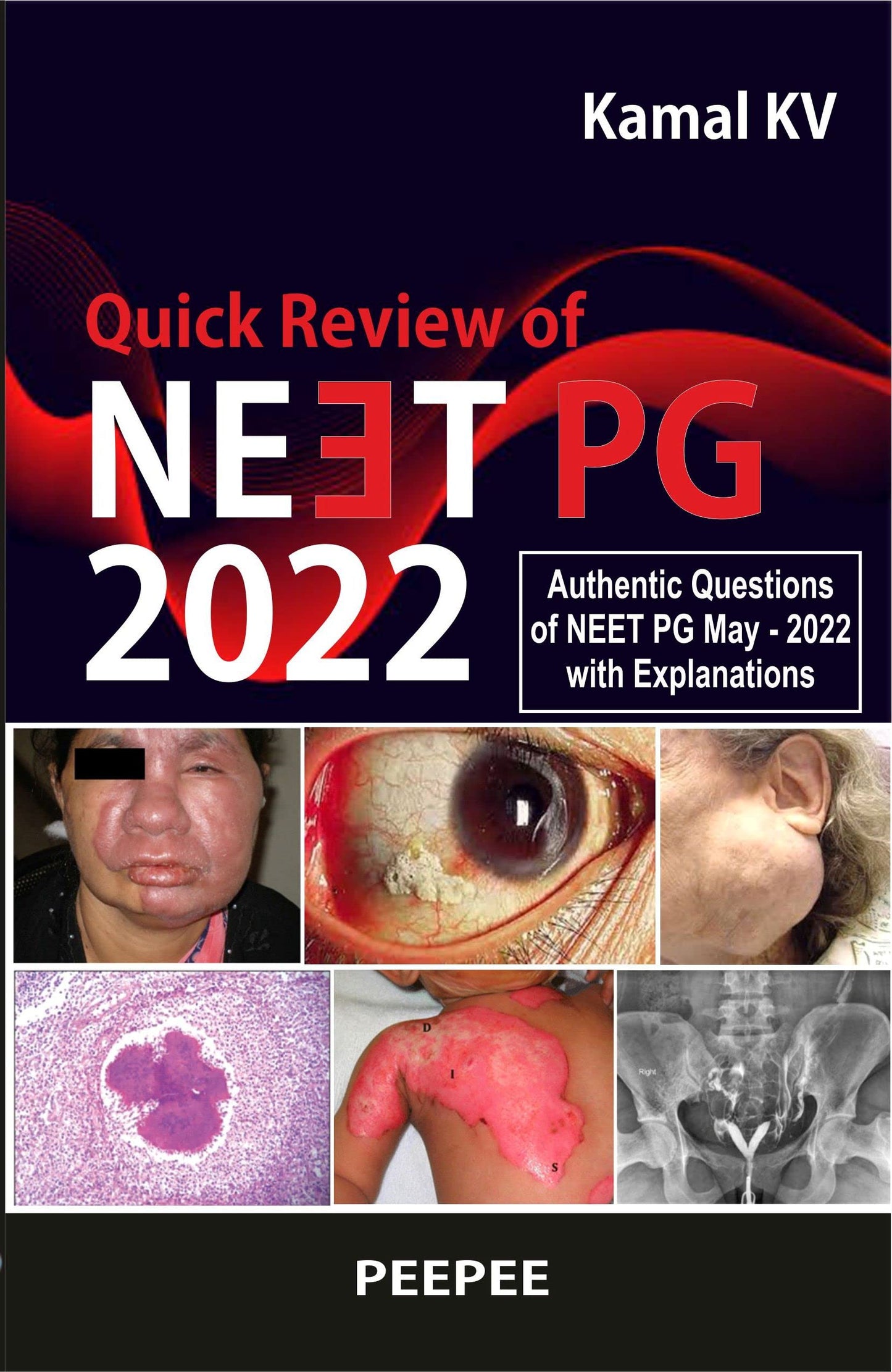 Quick Review Of Neet PG 2022-Kamal KV