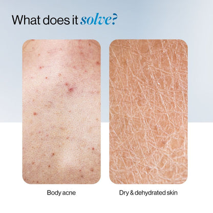 BeBodywise 1% Salicylic Ceramide Body Wash - Dual Pump 2in1 Body Wash - For Body Acne and Dry Skin