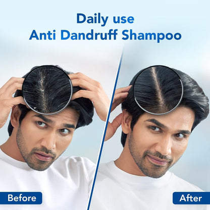 Anti-Dandruff Shampoo 100ml | Climbazole & Zpto Formula