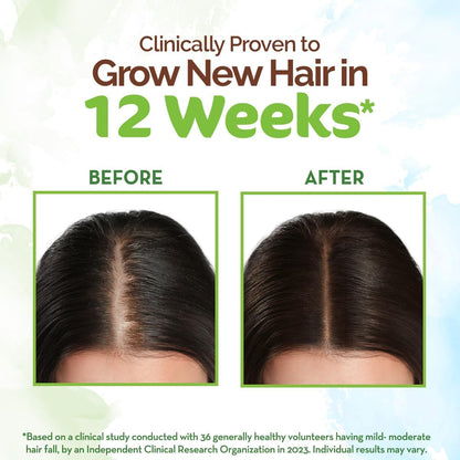 Rosemary Hair Growth Oil with Methi Dana, 200ml | Hair Fall Control