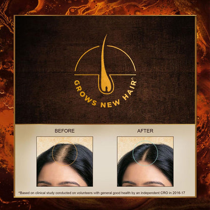 Ayurvedic Hair Oil 100ml - Hair Fall Control & Growth Formula