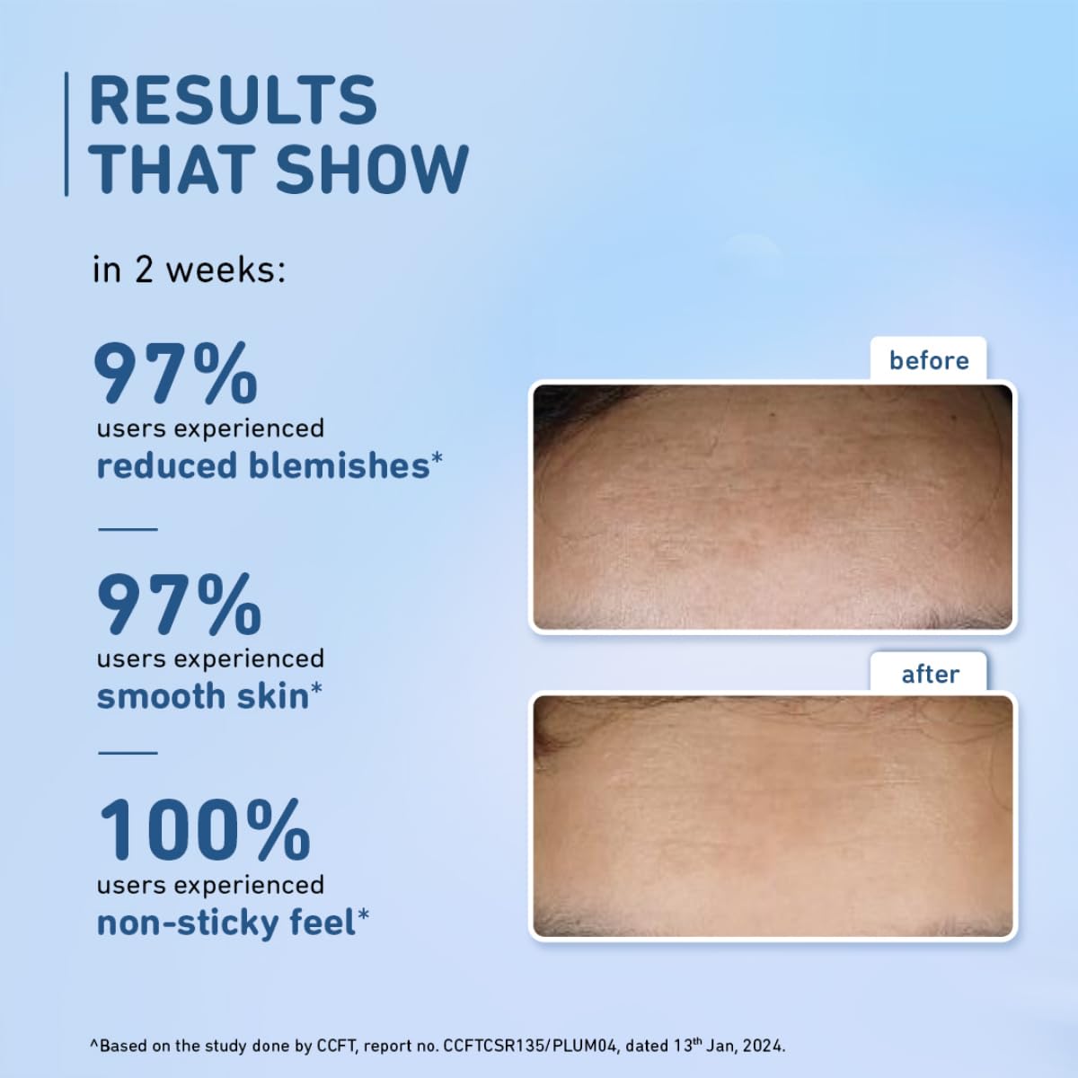 10% Niacinamide Serum with Rice Water, 15ml - Acne & Oil Control