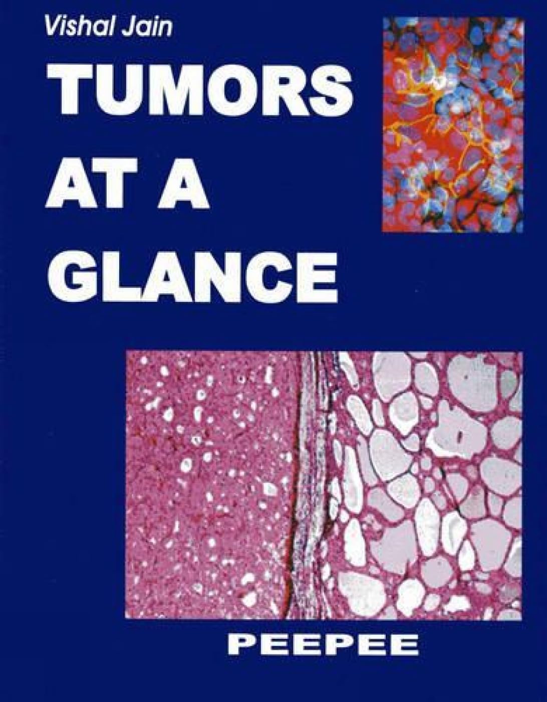 Tumors At A Glance: Volume 1-V K Jain