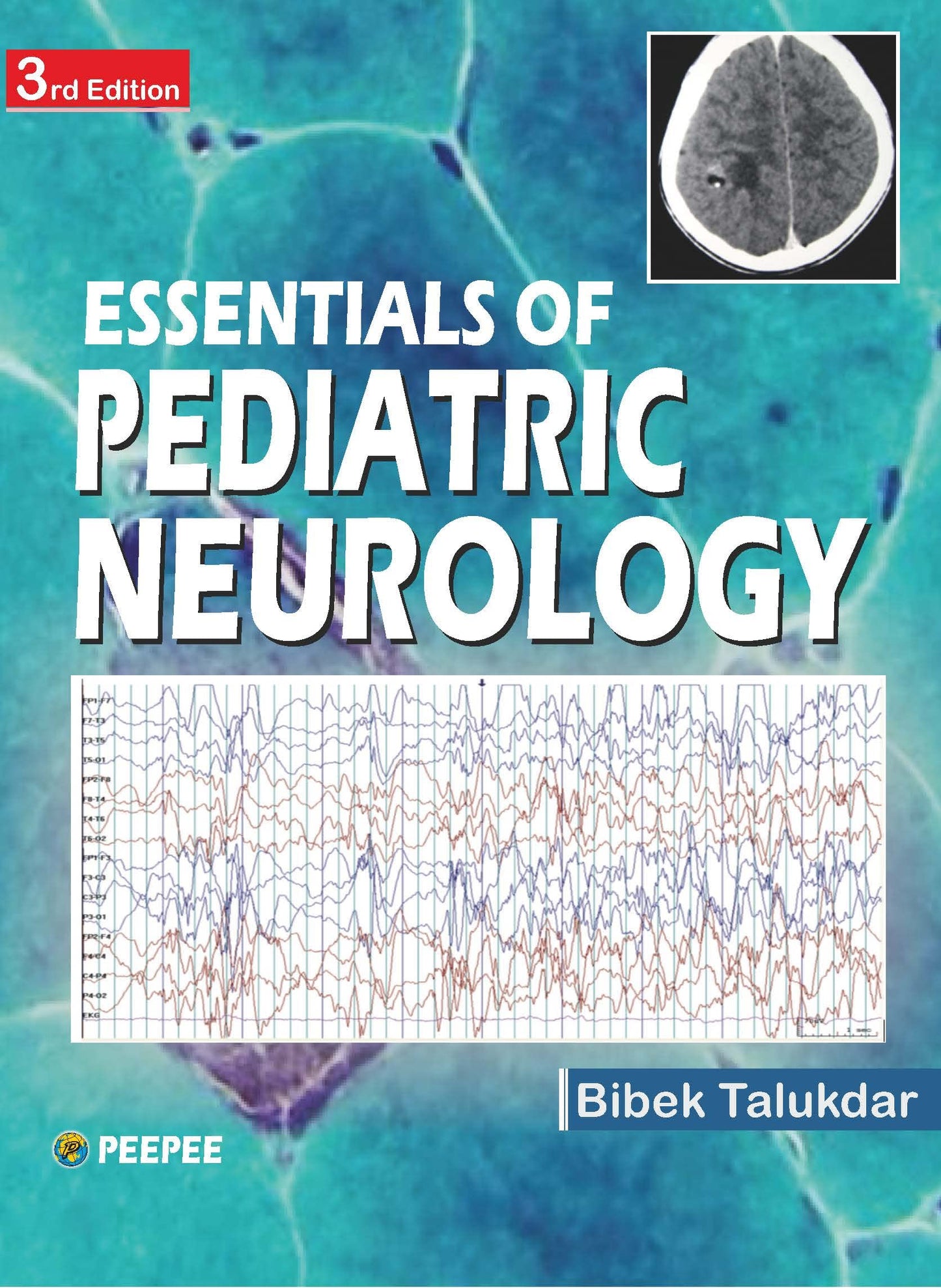 Essentials Of Pediatric Neurology 3E-Talukdar, Bibek