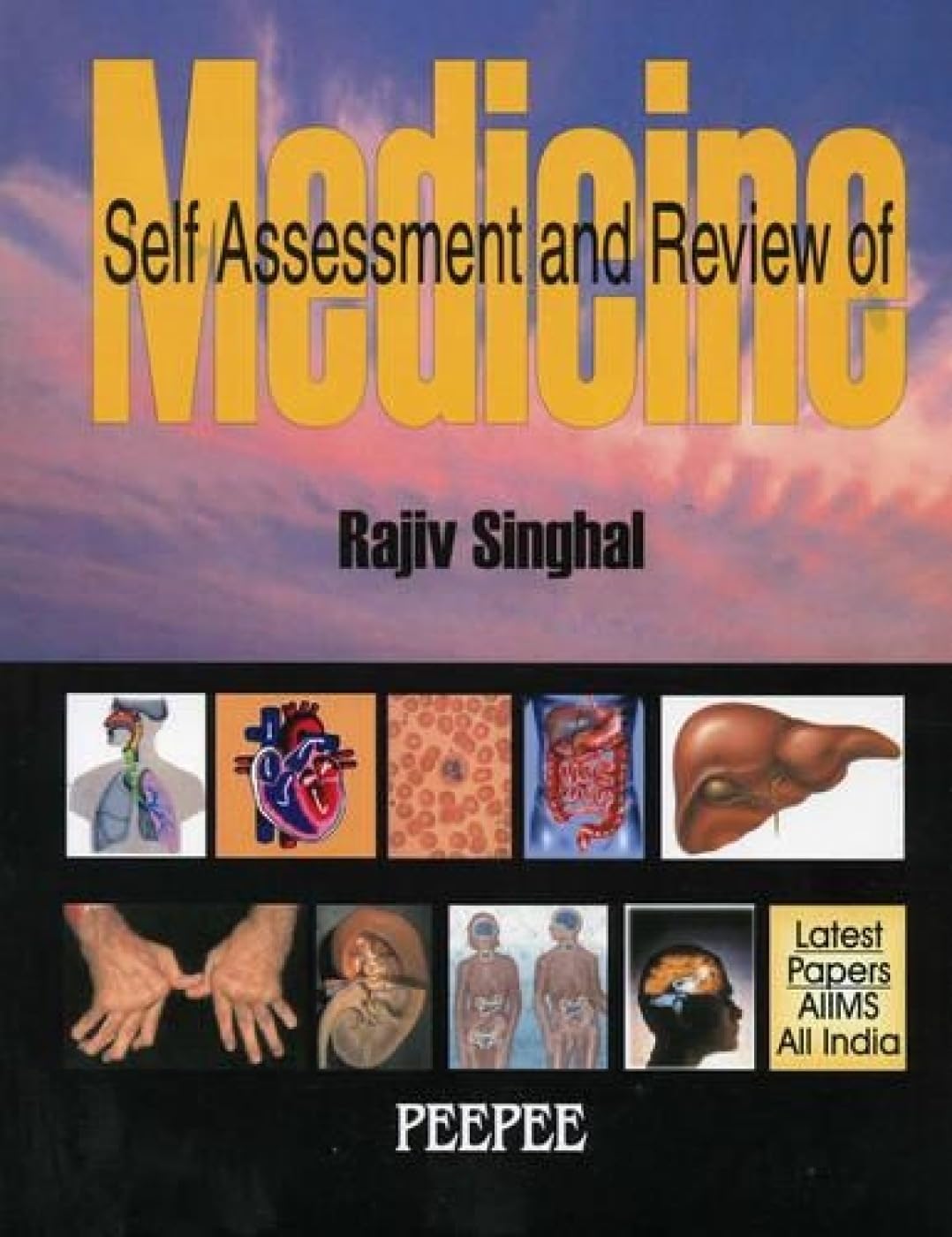 Self Assessment And Review Of Medicine-RK Singhal