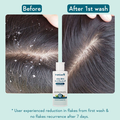 WishCare Hydrating AHA BHA Anti Dandruff Shampo-Reduces Flakes & Itchiness-100% Dandruff Reduction