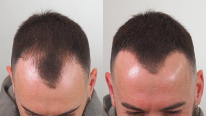 Black Hair Building Fibers 12g - Thickens Thin & Bald Spots