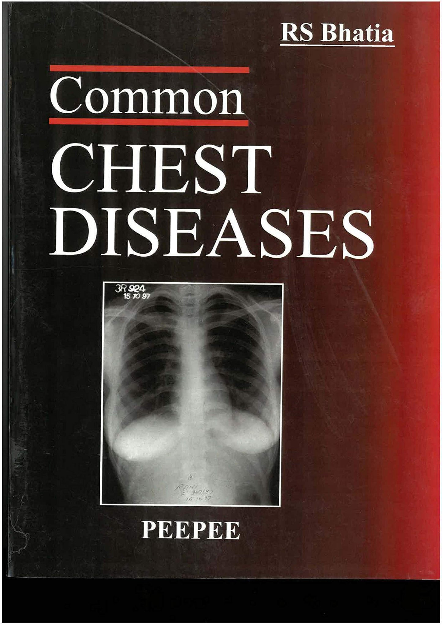 Common Chest Diseases-Bhatia, RS