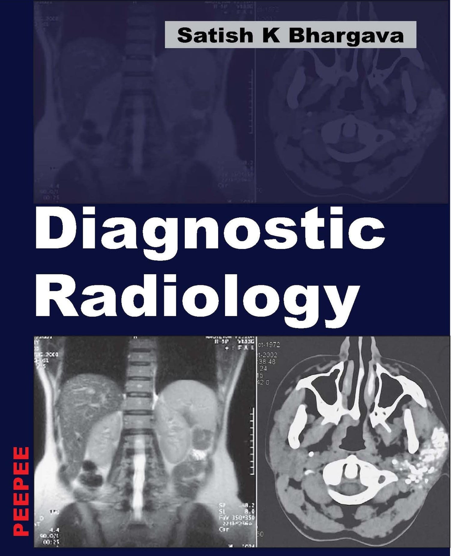 Diagnostic Radiology-Bhargava, Satish K
