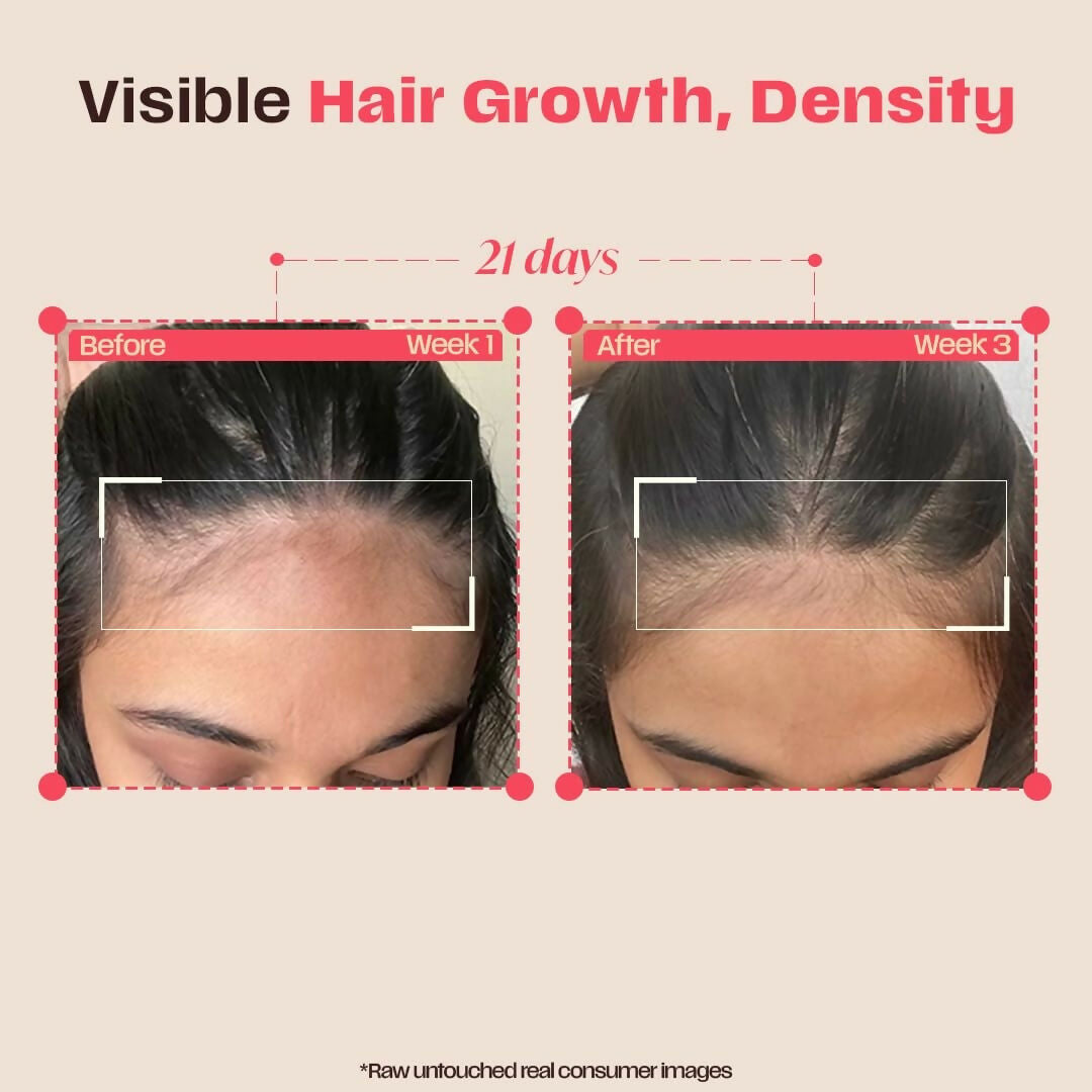 Days Ahead Leave-in Hair Growth Ampoule Serum (Roll on)