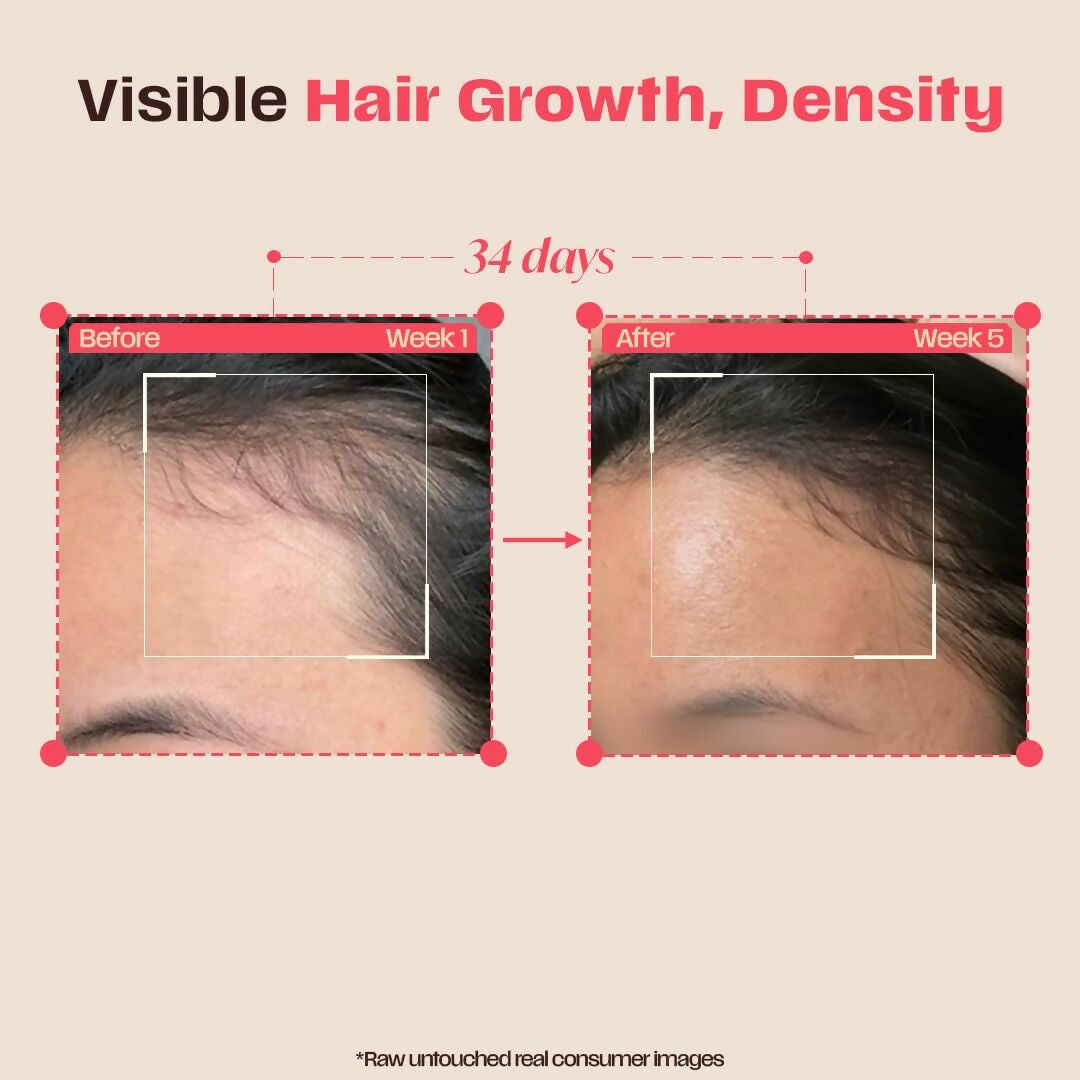 Days Ahead Leave-in Hair Growth Ampoule Serum (Roll on)