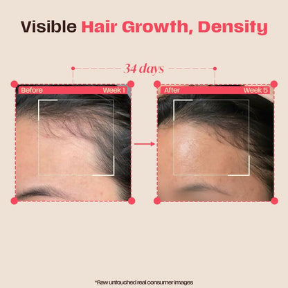 Days Ahead Leave-in Hair Growth Ampoule Serum (Roll on)