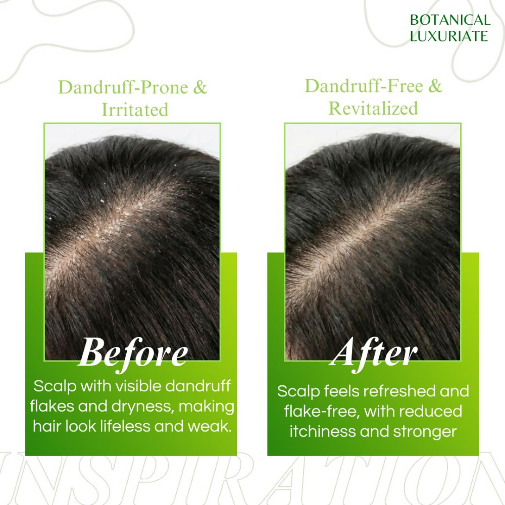 Botanical Luxuriate Amla & Rosemary Anti-Dandruff Shampoo