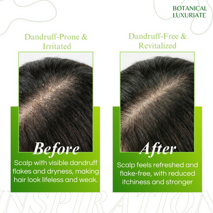 Botanical Luxuriate Amla & Rosemary Anti-Dandruff Shampoo