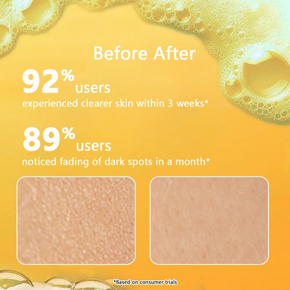 Milky Moon Vitamin C Face Wash for Brightening Face Cleanser