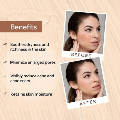 Glopetra Acne Scars & Pits Removal Gel