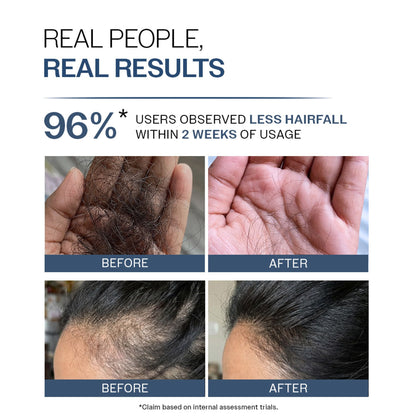 Bare Anatomy Anti-Hair Fall Shampoo 5X Hair Fall Control With Peptides