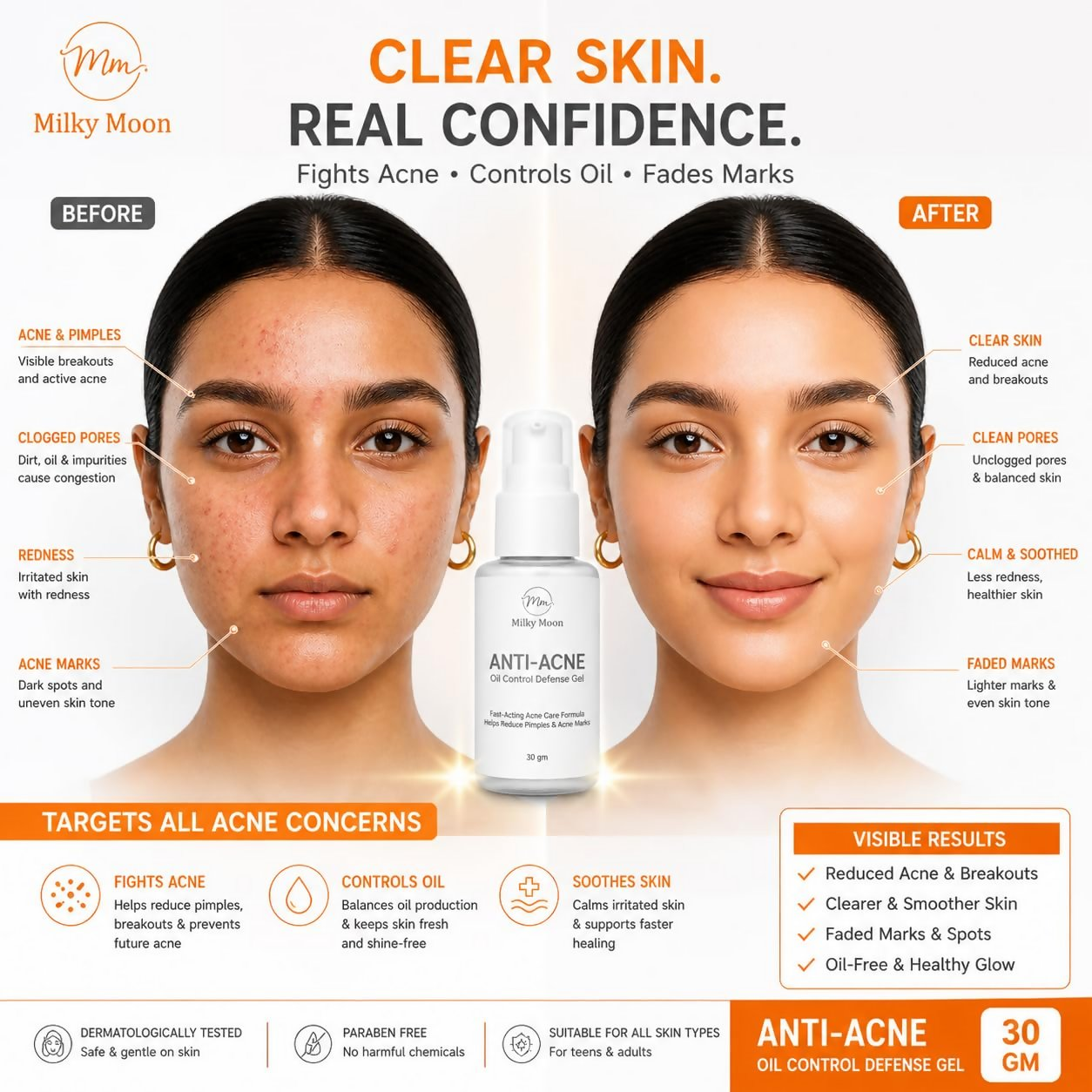 Milky Moon Rapid Relief Anti-Acne Gel