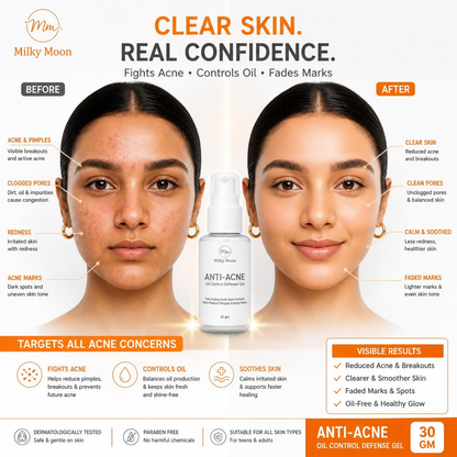 Milky Moon Rapid Relief Anti-Acne Gel