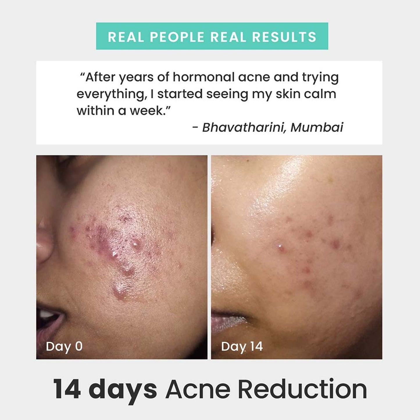 The Solved Skin Rapid Clear Face Wash