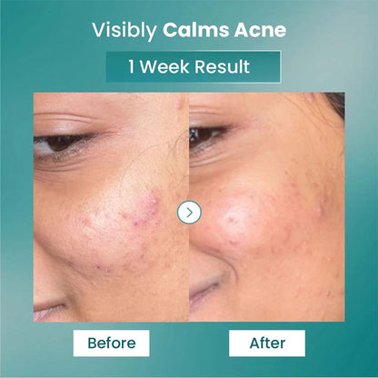 The Solved Skin Spot Fade Advance Repair Serum