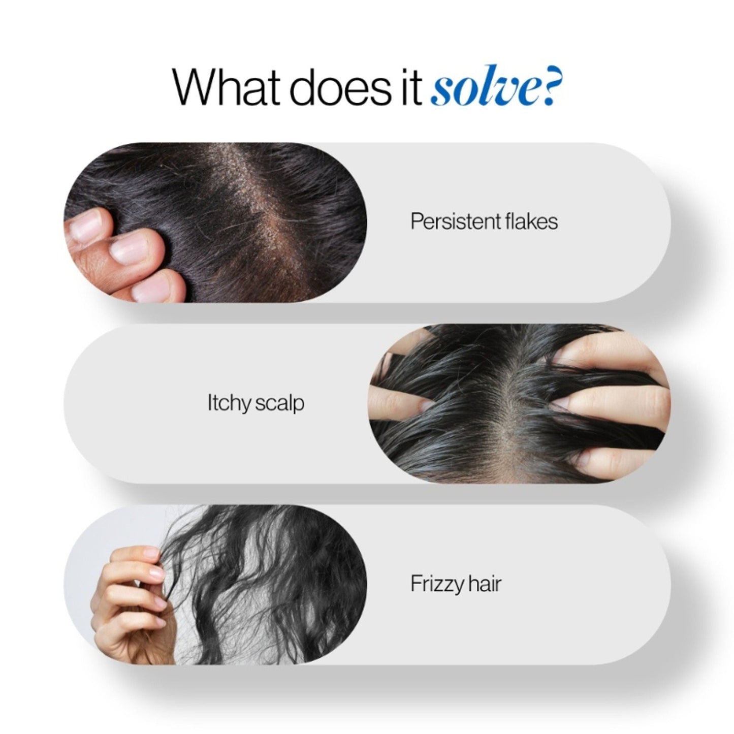 BeBodywise ZPTO Anti Dandruff Shampoo - Reduces Dandruff, Flaking & Deeply Hydrates Scalp
