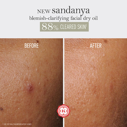 Kama Ayurveda Sandanya Blemish Clarifying Dry Oil