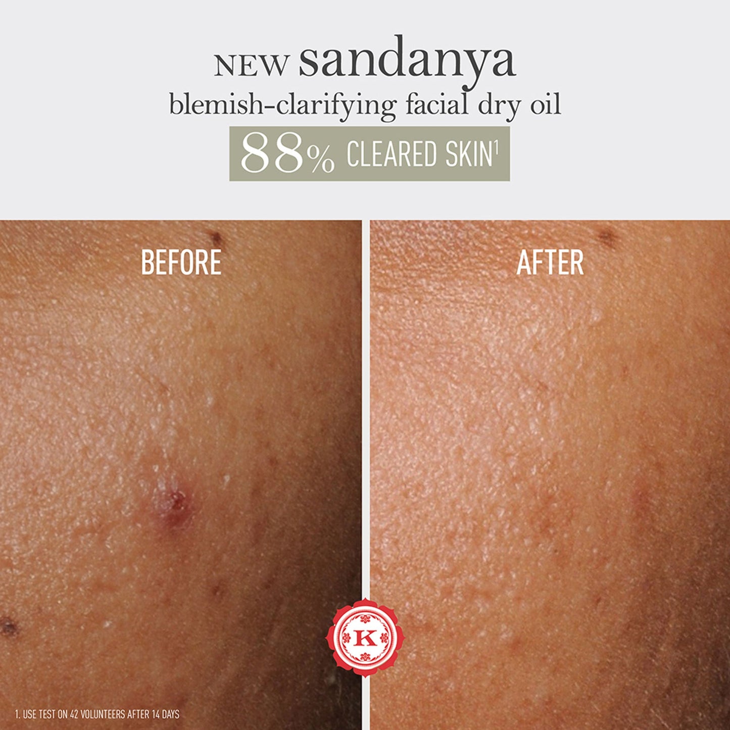 Kama Ayurveda Sandanya Blemish Clarifying Dry Oil