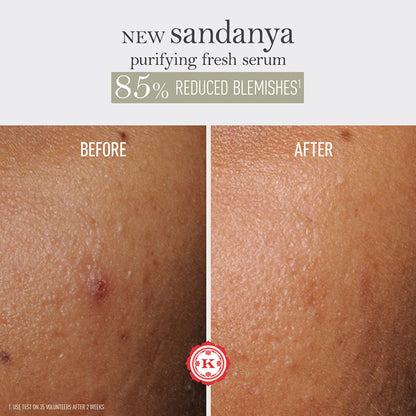 Kama Ayurveda Sandanya Purifying Fresh Serum