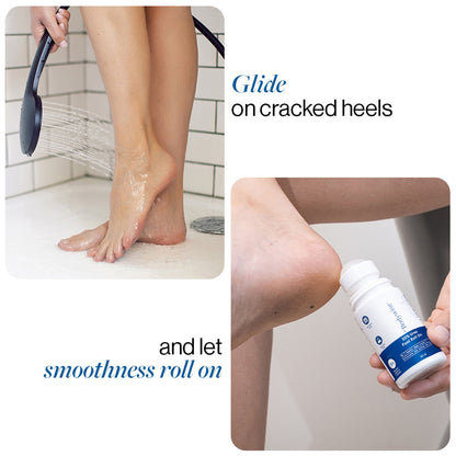BeBodywise 30% Urea Foot & Heel Roll On For Very Dry Feet & Cracked Heels