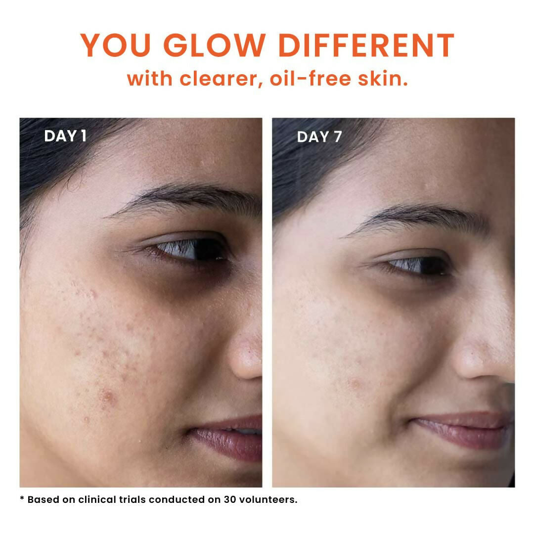 Foxtale Oil & Acne Control Face Wash