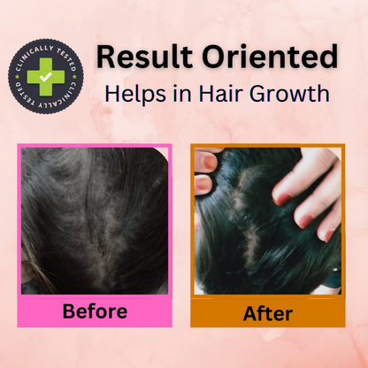 Curista Naturals Arnica Jaborandi Hair Growth Oil
