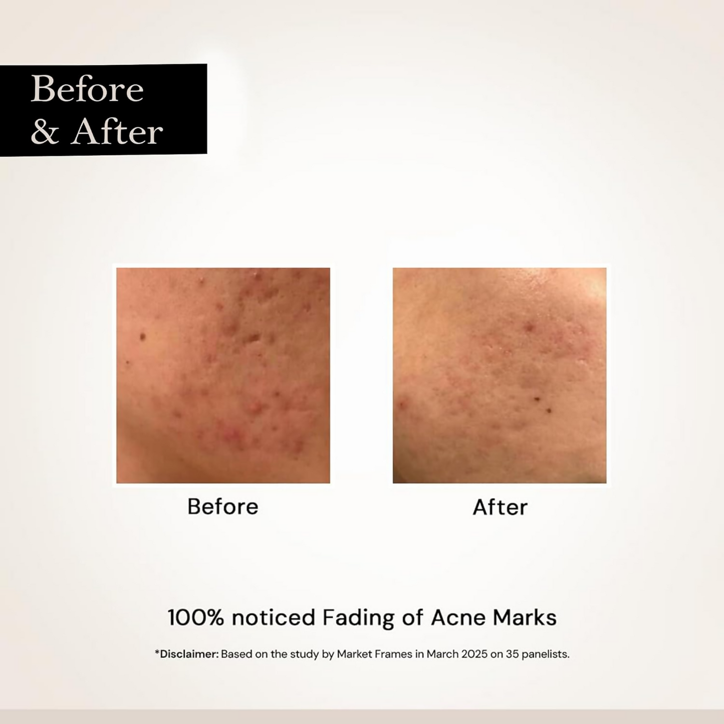 Milky Moon Face Glow Night Serum Dark Spot & Brightening Face Serum