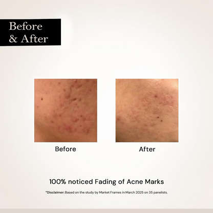 Milky Moon Face Glow Night Serum Dark Spot & Brightening Face Serum
