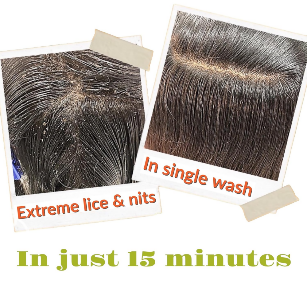 Botanical Luxuriate Tea Tree Anti Lice and Nits Shampoo